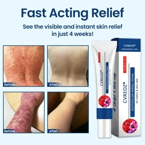 SootheGlow Herbal Cream