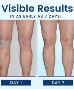 SootheGlow Herbal Cream