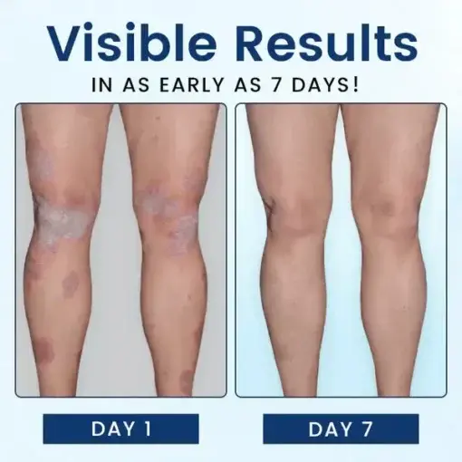 SootheGlow Herbal Cream