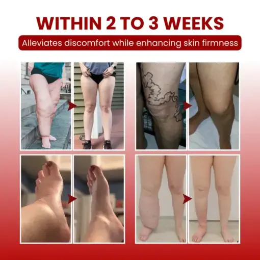 SwellCare Professional Lymphatic Drainage Massage Cream