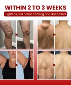 SwellCare Professional Lymphatic Drainage Massage Cream