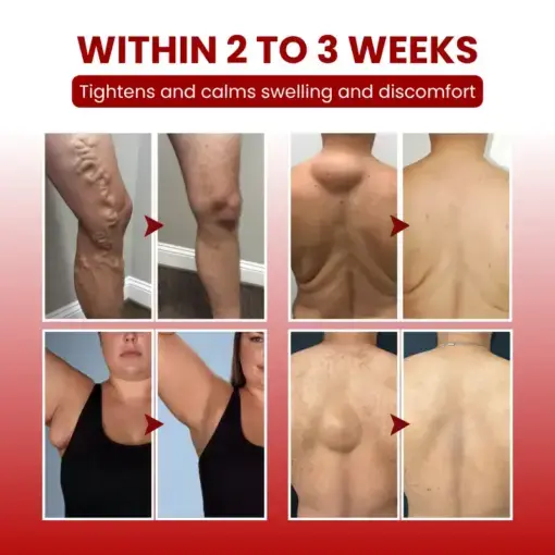 SwellCare Professional Lymphatic Drainage Massage Cream