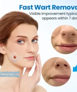 TagGone Wart Removal Cream