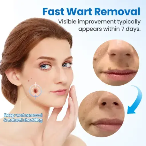 TagGone Wart Removal Cream