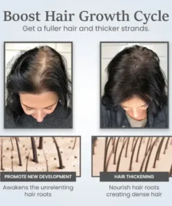 ThickTress Hair Growth Spray