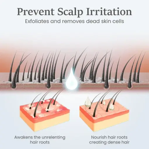 ThickTress Hair Growth Spray