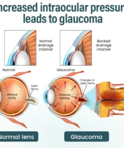 Timilk® OptiFusion Nano Eye Drops Serum