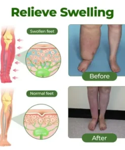 Timilk® Professional Leg Circulation Cream