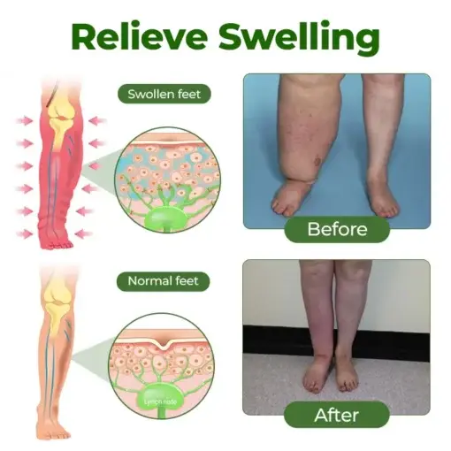 Timilk® Professional Leg Circulation Cream