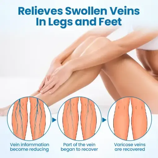 Timilk® VeinGuard Herbal Spray