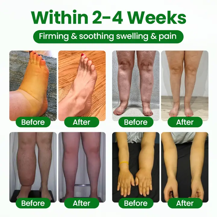 VenoLift Leg Relief Spray - Image 4