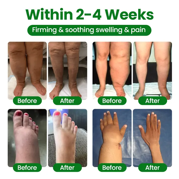 VenoLift Leg Relief Spray - Image 3