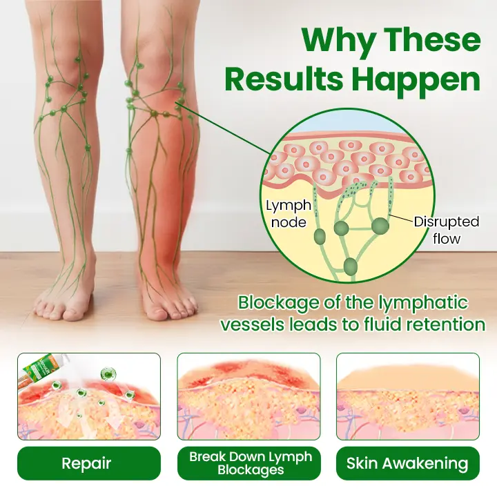 VenoLift Leg Relief Spray - Image 2