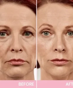 V-Face Lifting Invisible Adhesive Tape