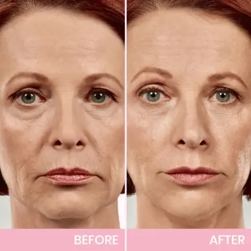 V-Face Lifting Invisible Adhesive Tape