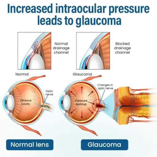 VisionReborn Nano Eye Drops