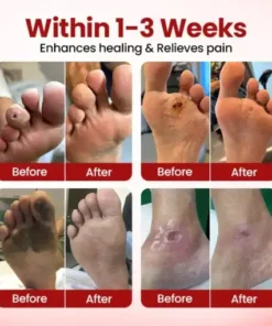 VitaGluco Diabetic Care Cream