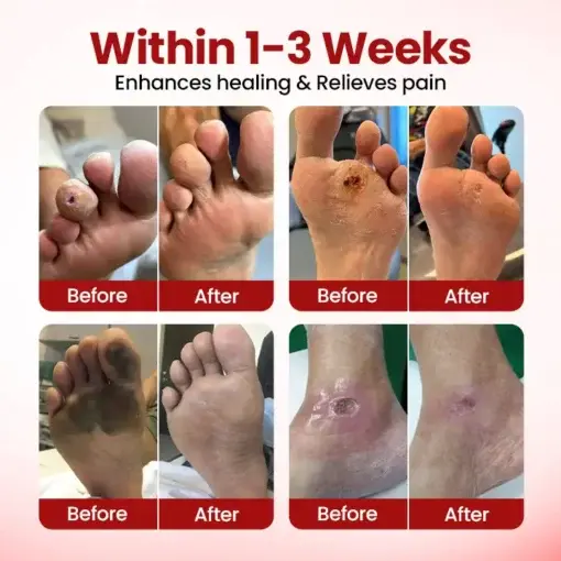 VitaGluco Diabetic Care Cream