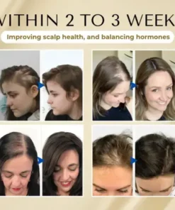 VitaStrand Biotin Hair Growth Spray