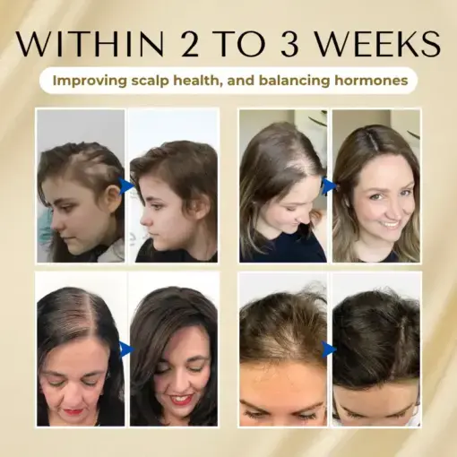 VitaStrand Biotin Hair Growth Spray