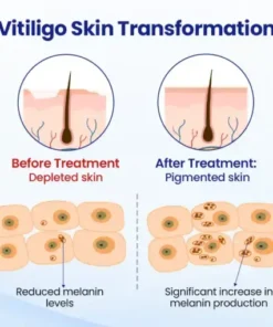 VitiClear Herbal Spray