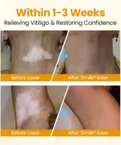 VitiGone Rapid Spray