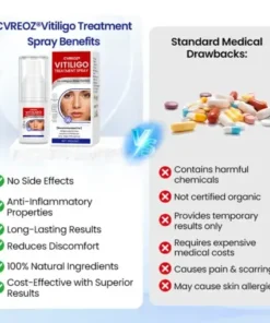 Vitiligo Treatment Spray