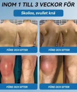 đŻđđŒđ±đŒÂź BPC-157 LedhĂ€lsande krĂ€m