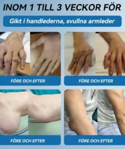 đŻđđŒđ±đŒÂź BPC-157 LedhĂ€lsande krĂ€m