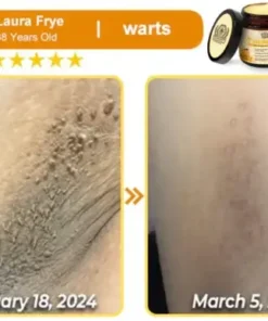 Bee Essence Skin Antibacterial Cream