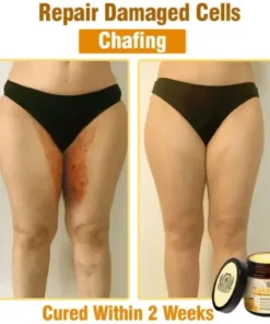 Bee Essence Skin Antibacterial Cream