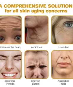 Botox Bee Venom Wrinkle Removal Cream