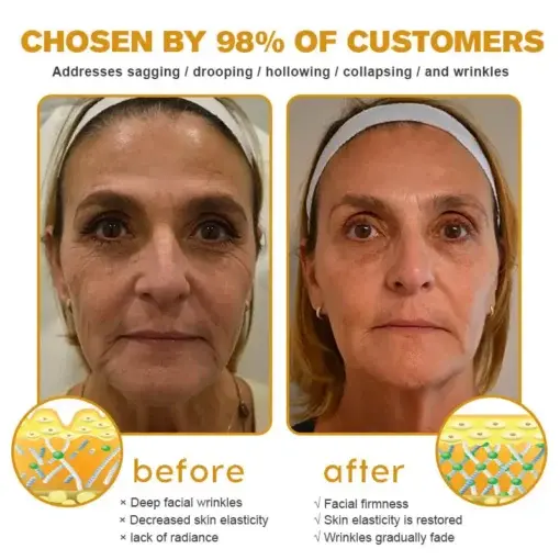 Botox Bee Venom Wrinkle Removal Cream