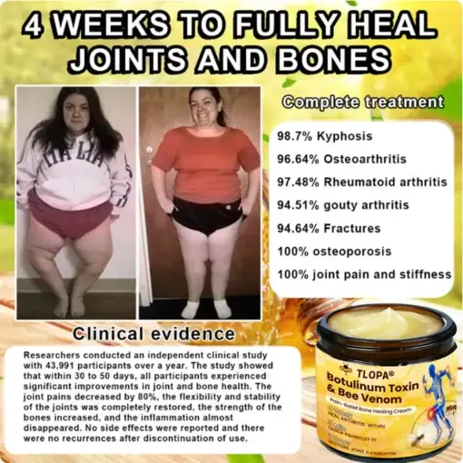 Botulinum Toxin & Bee Venom Pain-Relief Bone Healing Cream