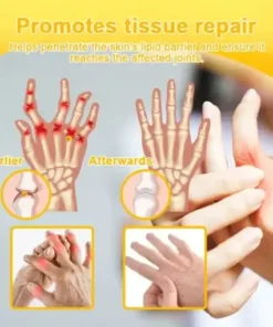 Botulinum Toxin & Bee Venom Pain-Relief Bone Healing Cream