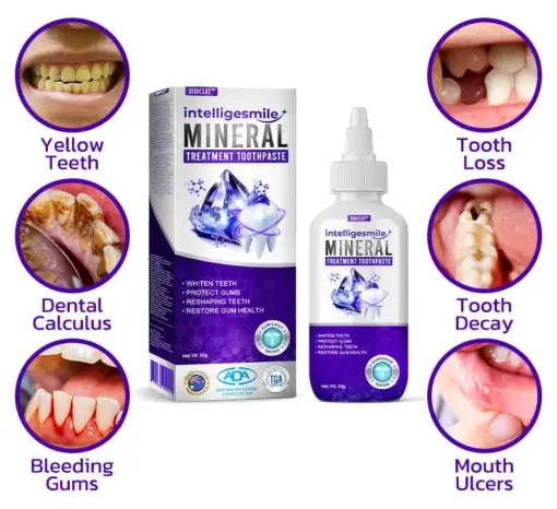 IntelligeSmile Mineral Treatment Toothpaste