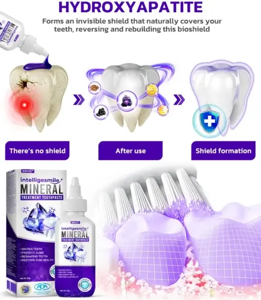 IntelligeSmile Mineral Treatment Toothpaste