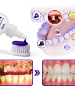 IntelligeSmile Mineral Treatment Toothpaste
