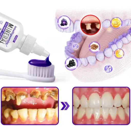 IntelligeSmile Mineral Treatment Toothpaste