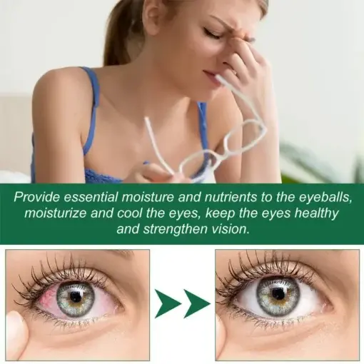 Presbyopia Eye Drops