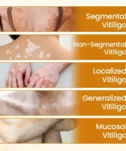 VitiClear Pro Bee Venom Cream